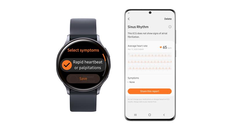 Samsung_Health_Monitor_ECG_03-1.jpg